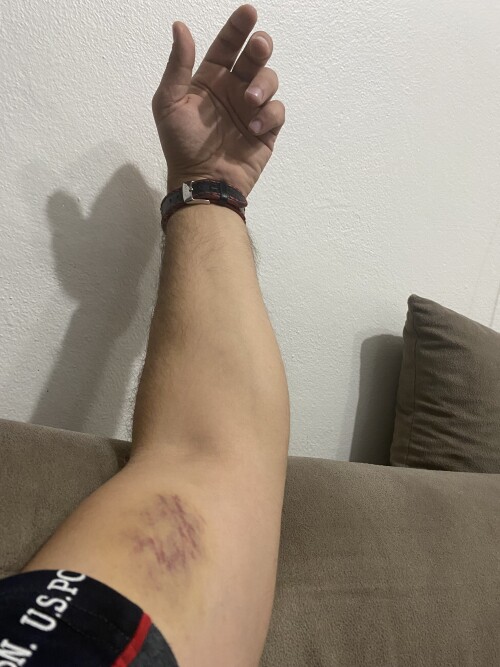 IMG 1869