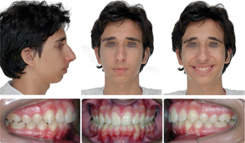 416869 2 En 3 Fig23 HTML